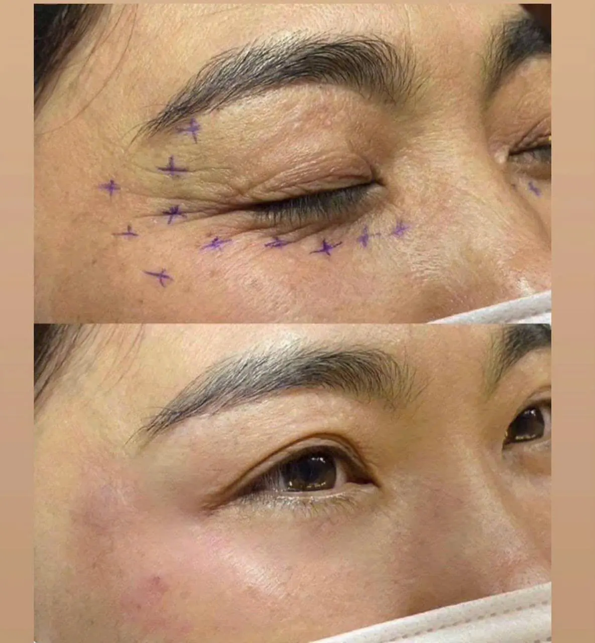EVER BEAUTÉ CENTER